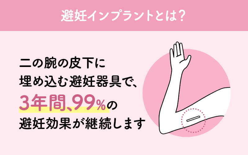 避妊インプラントは二の腕に埋め込む避妊具