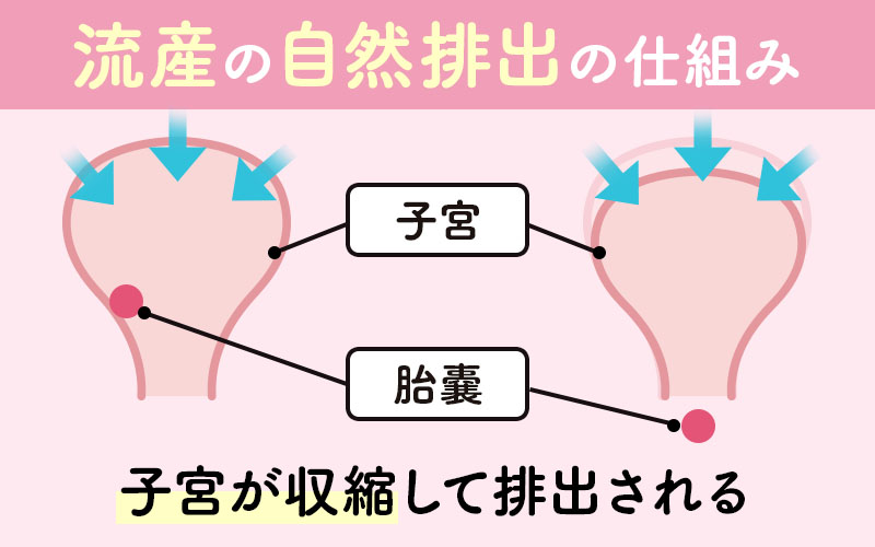 流産の自然排出の仕組み